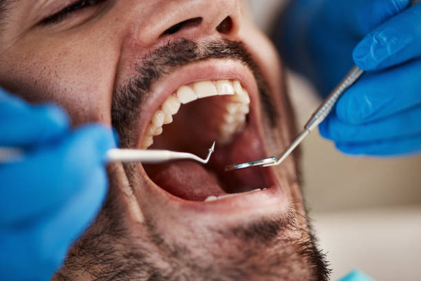 Best Emergency Cosmetic Dentistry (e.g., broken veneers) in Briggs, OK